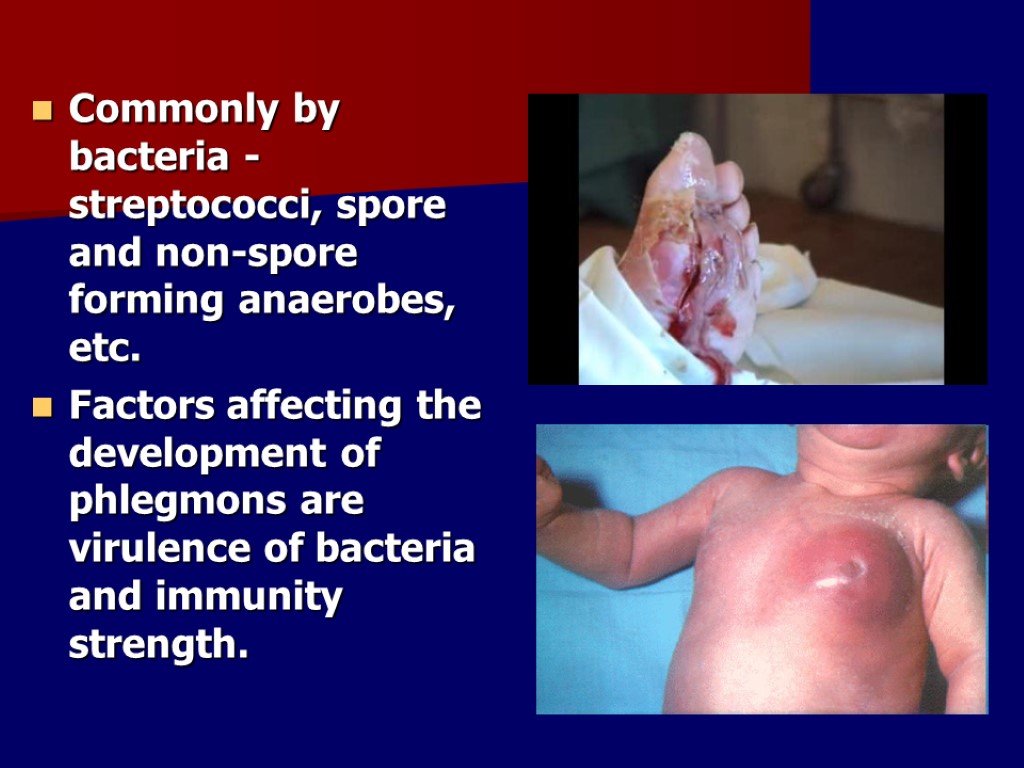 Commonly by bacteria - streptococci, spore and non-spore forming anaerobes, etc. Factors affecting the